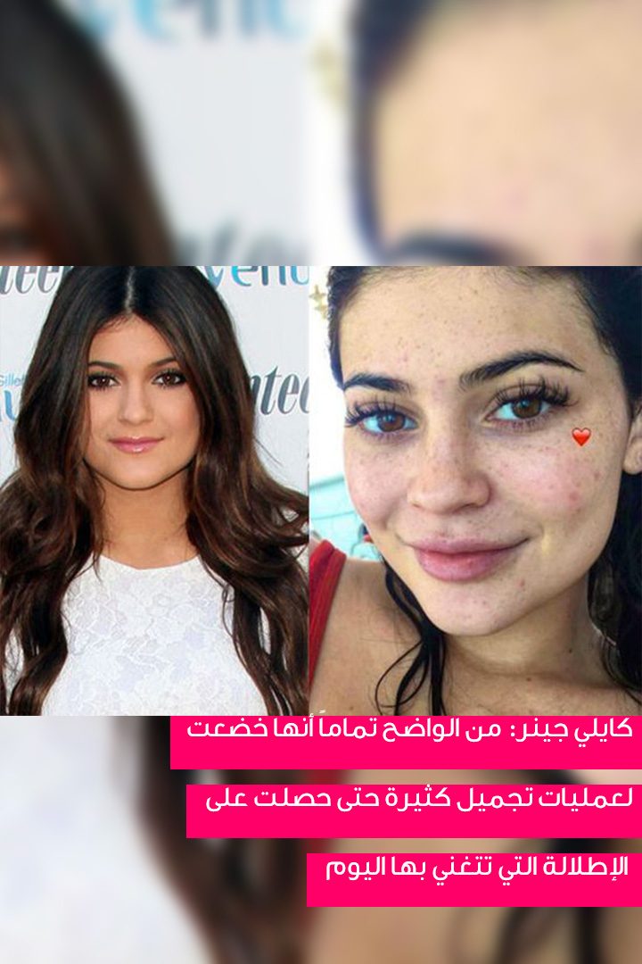 story النجمات اللواتي لم يظهرن أبداً من دون ماكياج قبل عمليات التجميل