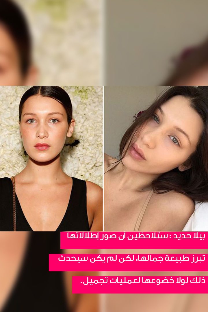 story النجمات اللواتي لم يظهرن أبداً من دون ماكياج قبل عمليات التجميل
