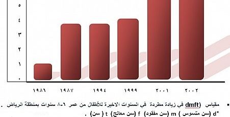 إرتفاع نسبة تسوس الأسنان بين السعوديين إلى 93%!    