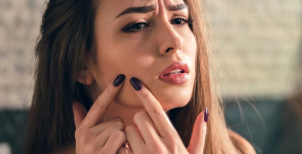 مأكولات تسبب حب الشباب تجنبي تناولها بكثرة