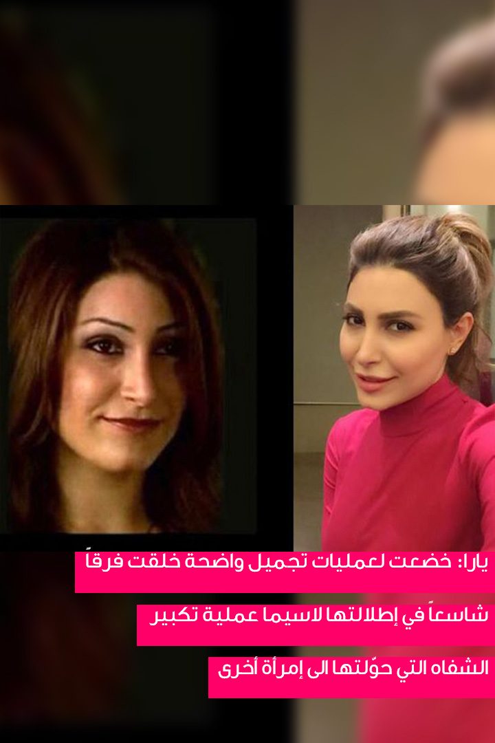 story النجمات اللواتي لم يظهرن أبداً من دون ماكياج قبل عمليات التجميل