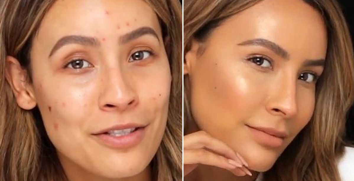 اليك حيلة الماكياج الذكية التي طبقتها هذه المدونة لإخفاء حبّ الشباب نهائياً