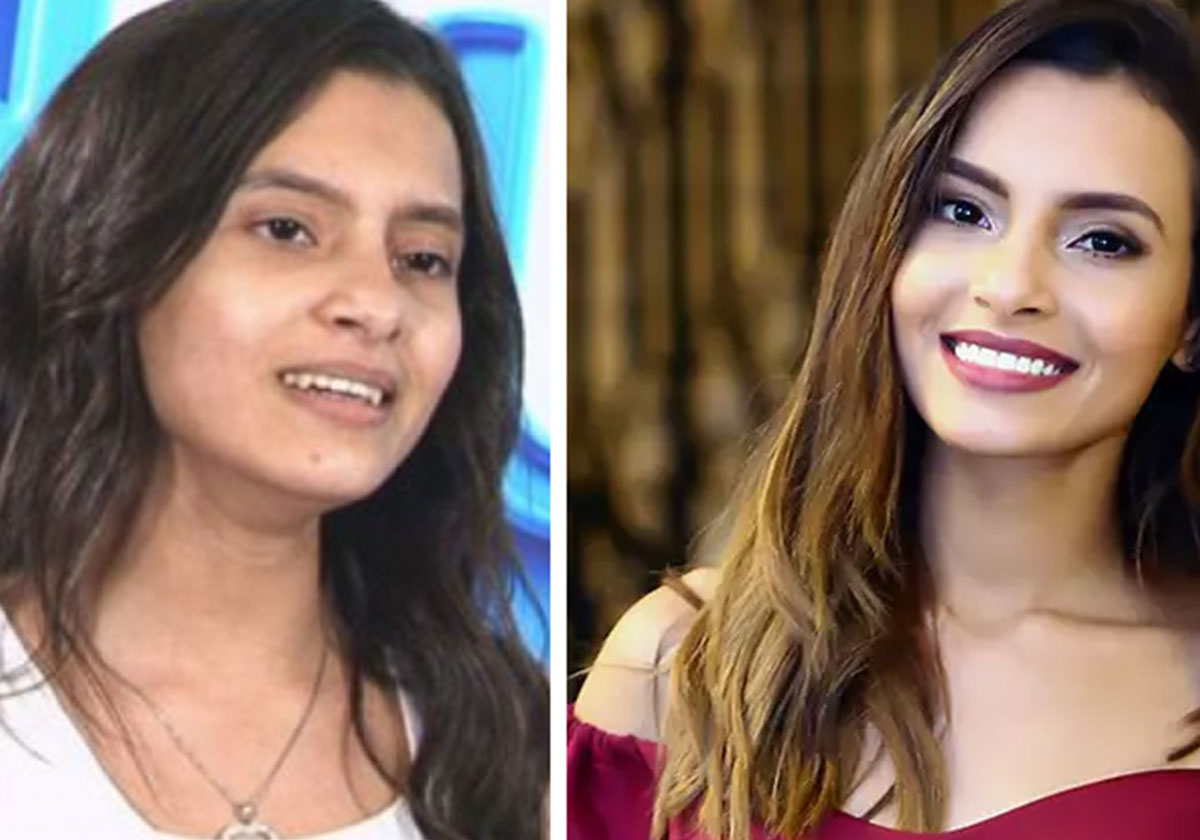 كارمن سليمان قبل التجميل وبعده