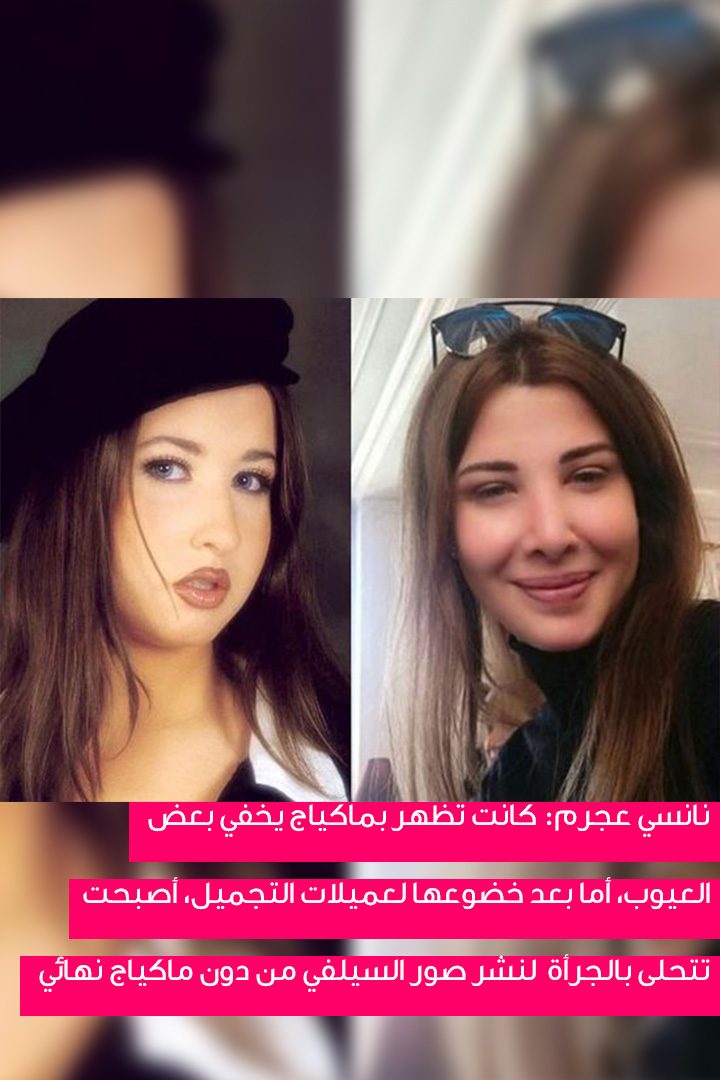 story النجمات اللواتي لم يظهرن أبداً من دون ماكياج قبل عمليات التجميل