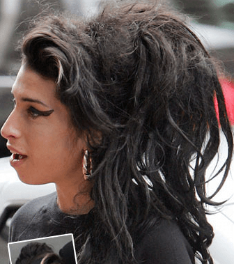 Amy-Winehouse-hair-loss-23-3-2011