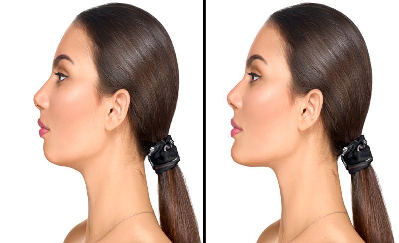 4 حيل مكياج لتنحيف الوجه لا تستغني عنها!