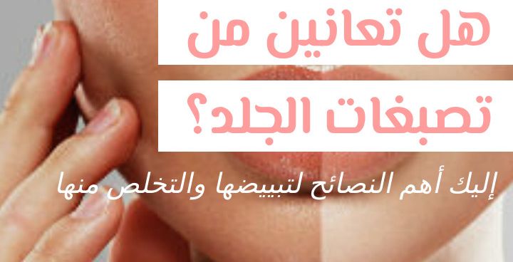 Story هل تعانين من تصبغات الجلد؟