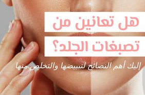 Story هل تعانين من تصبغات الجلد؟