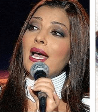 صور اسنان النجمات العربيات قبل التجميل