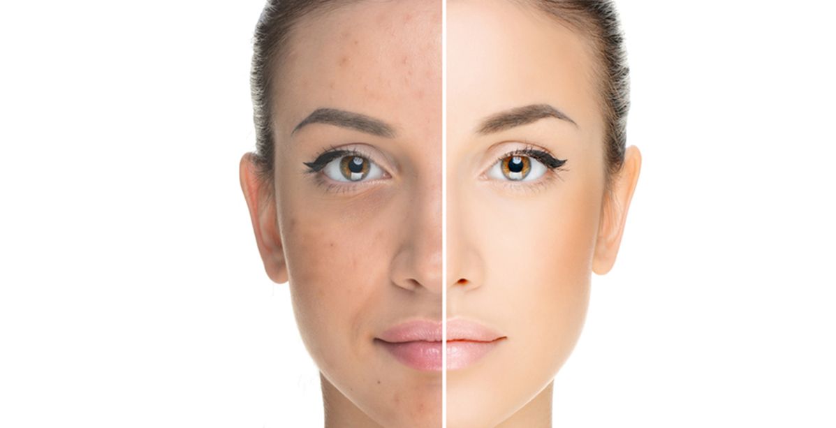 غسلت وجهها بالألوفيرا لمدة 7 أيّام...وهذه كانت النتيجة المذهلة! 