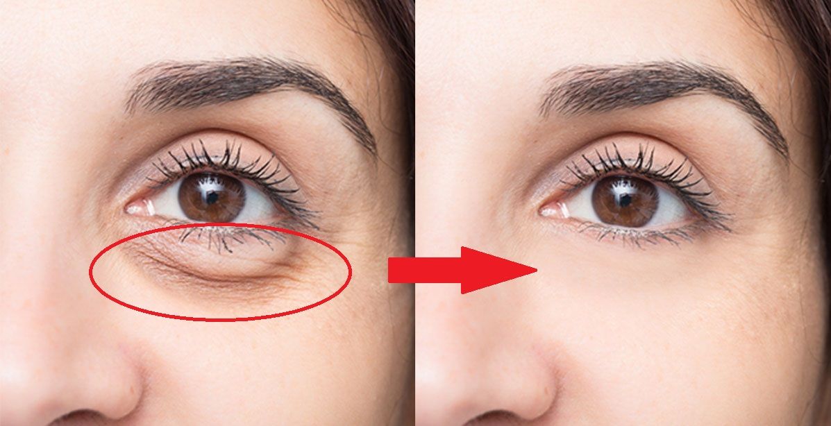 أضيفي هذين المكونين الى الفازلين وعالجي مشكلة الجيوب المنتفخة نهائياً!