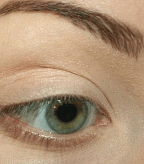 الخطوة الثانية: تحديد طرف العين