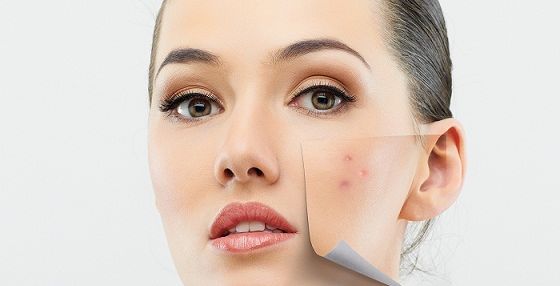ودّعي البثور بالعناية اليومية