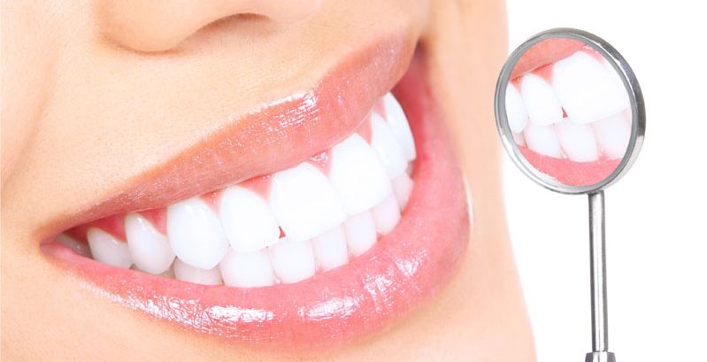 تبييض الاسنان بالبيت