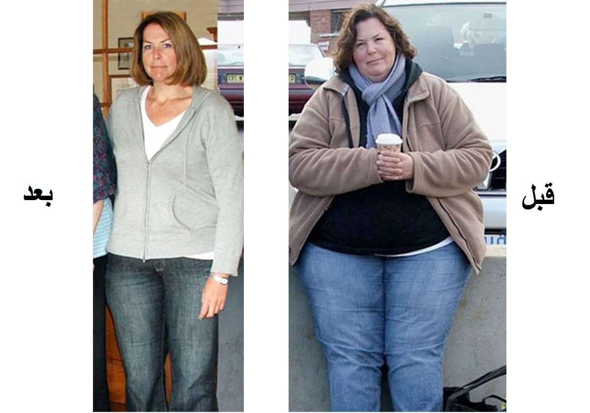 حيلة واحدة ساعدتها على خسارة 40 كيلوغراماً من وزنها خلال أشهر!
