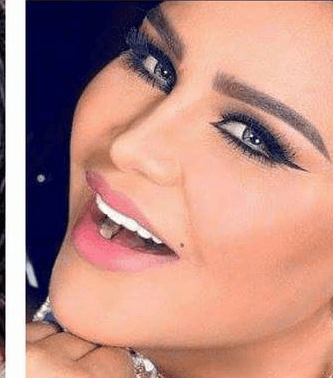 صور اسنان النجمات العربيات قبل التجميل