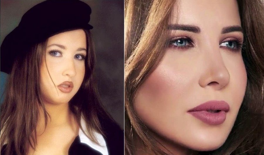 نانسي عجرم قبل بعد عملية تجميل الأنف