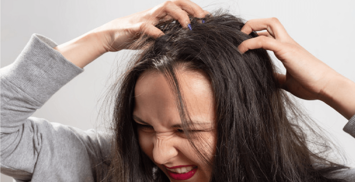 كيف اتخلص من الصيبان العالق بالشعر