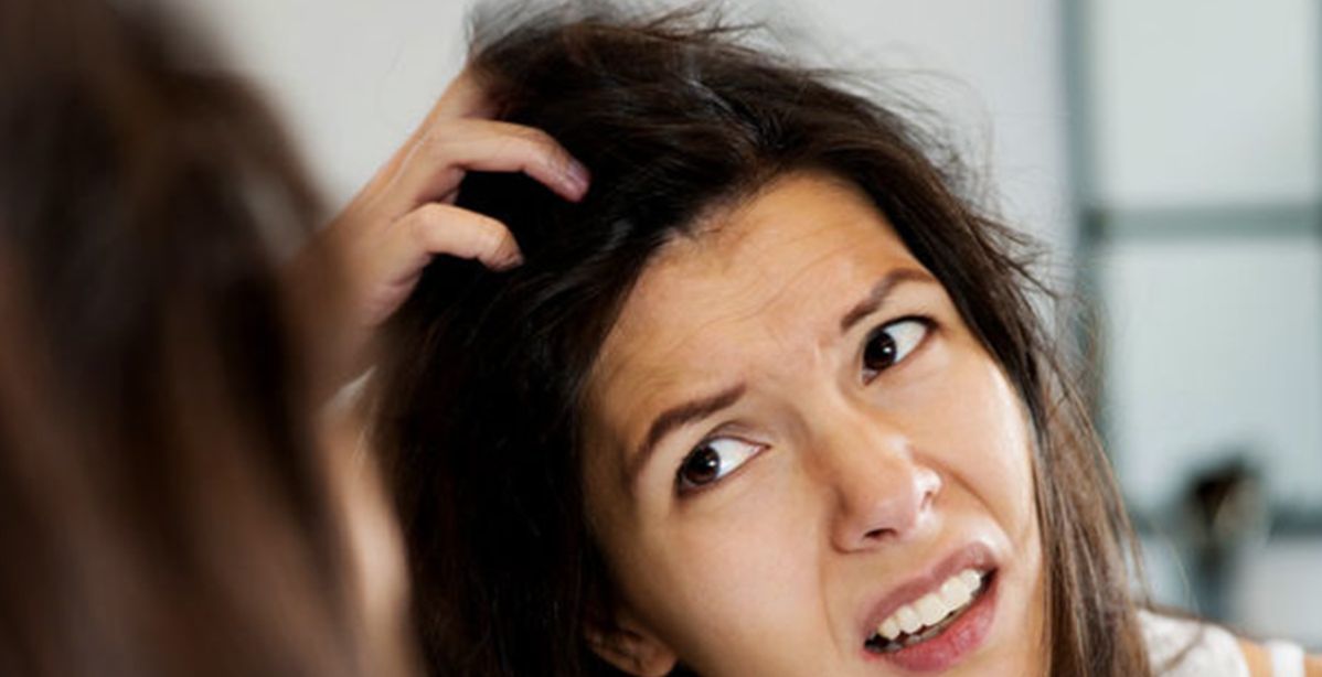 اسباب أعراض وطرق علاج اكزيما الشعر الدهنية