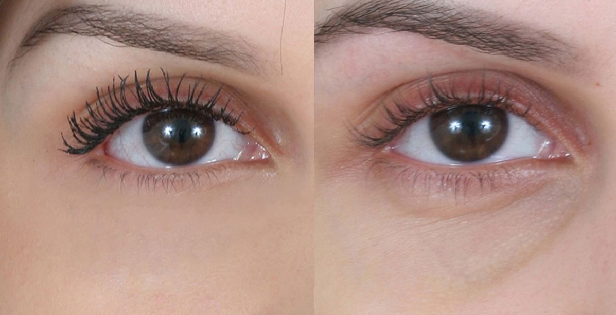 وصفة عجائبية تغنيك عن الفيلر تحت العين وتزيل تجويف البشرة!