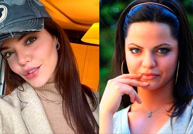 بطلة مرارة الحب قبل عمليات التجميل