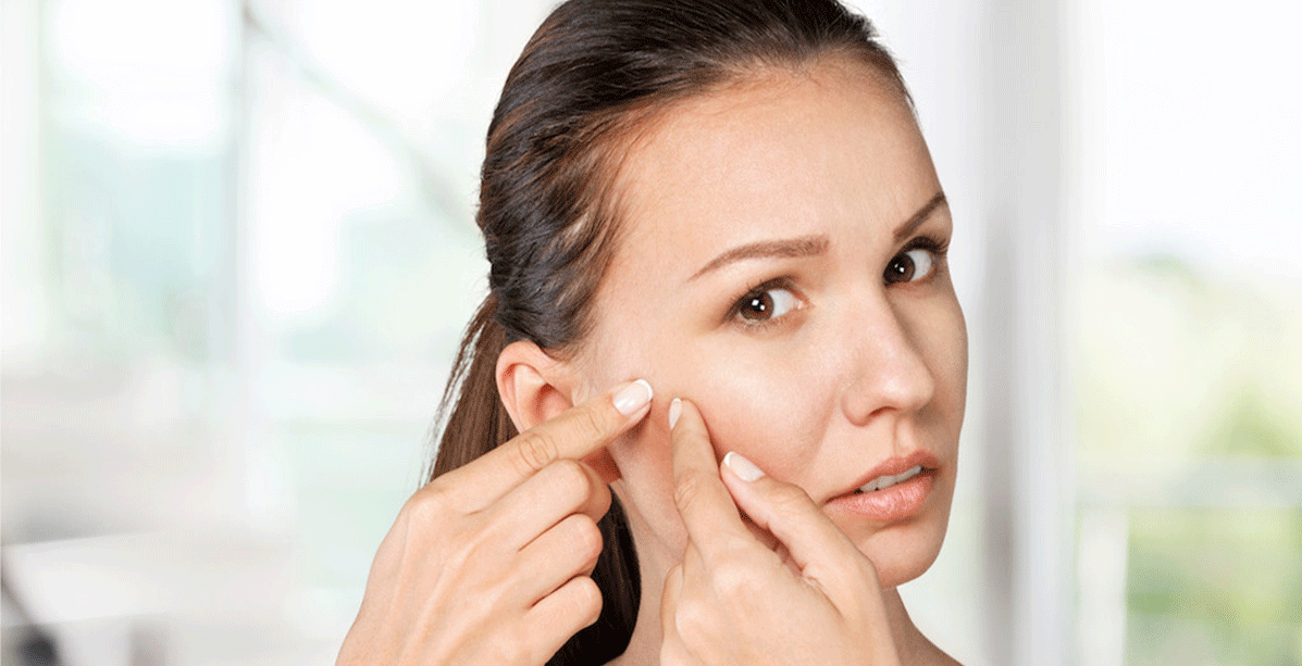 اليك اهم اسباب حبوب الوجه عند البالغات