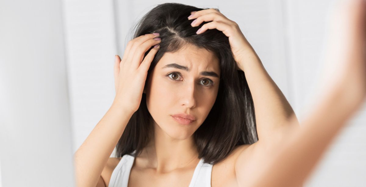 كيف أزيل القشرة من الشعر 