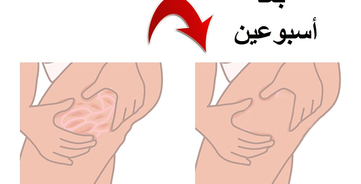 طبقي هذه التمارين ل 10 دقائق في الصباح وودعي السيلوليت نهائياً!