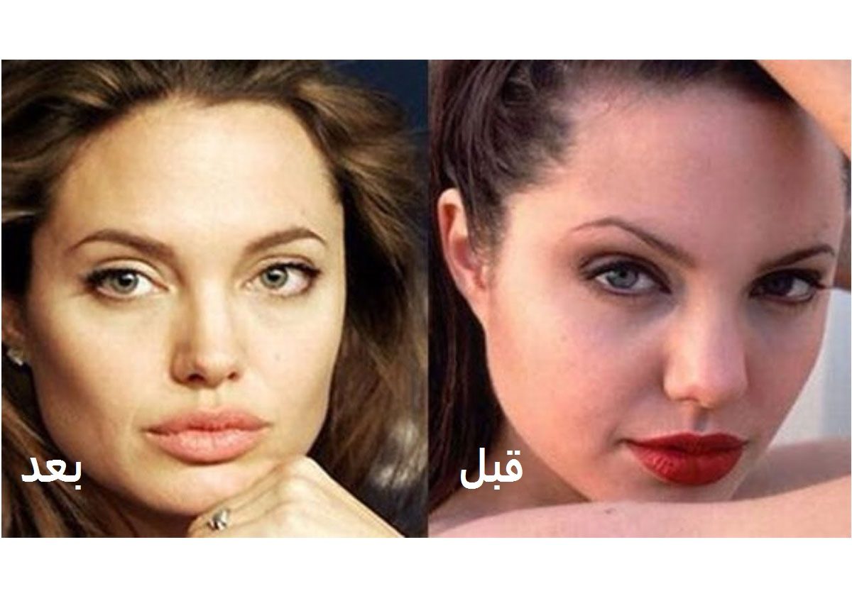 بالصور: كيف تغير وجه أنجلينا جولي بعد عملية تجميل الأنف؟