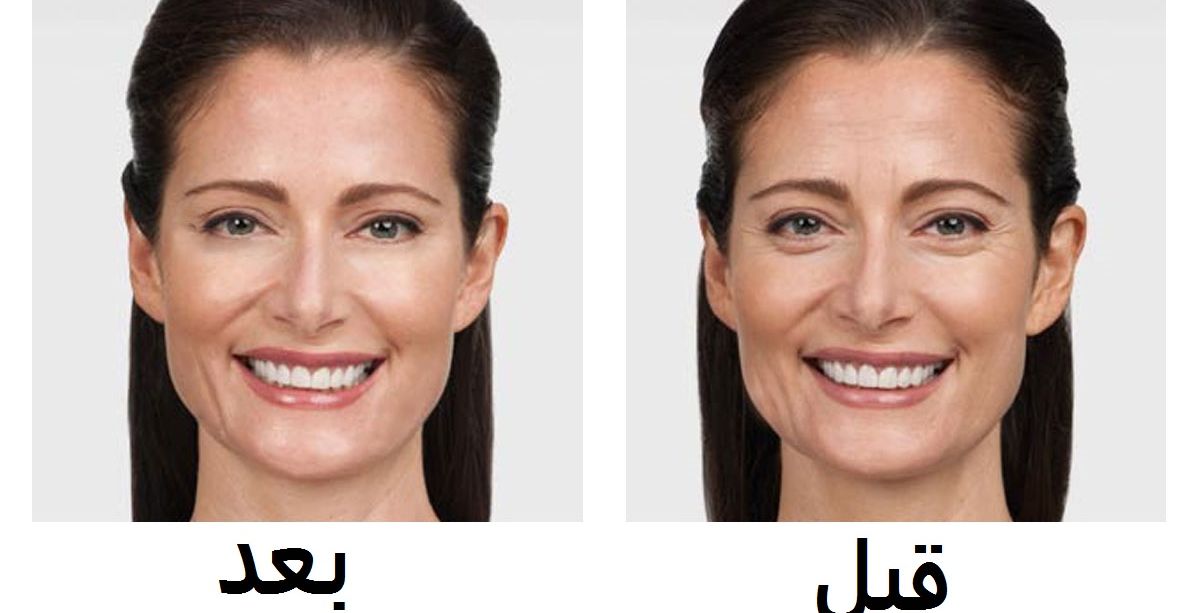 اكسير الشباب: تناولي ملعقة من هذا المشروب يومياً وامحي أثر التجاعيد من بشرتك!