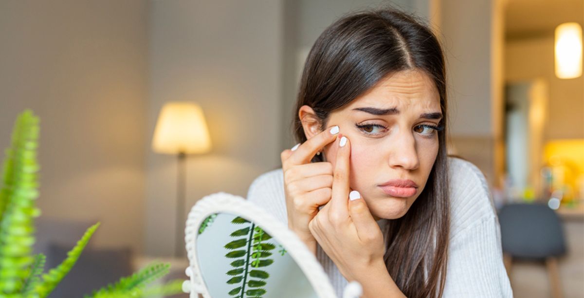 إزالة الحبوب من الوجه الدهني 