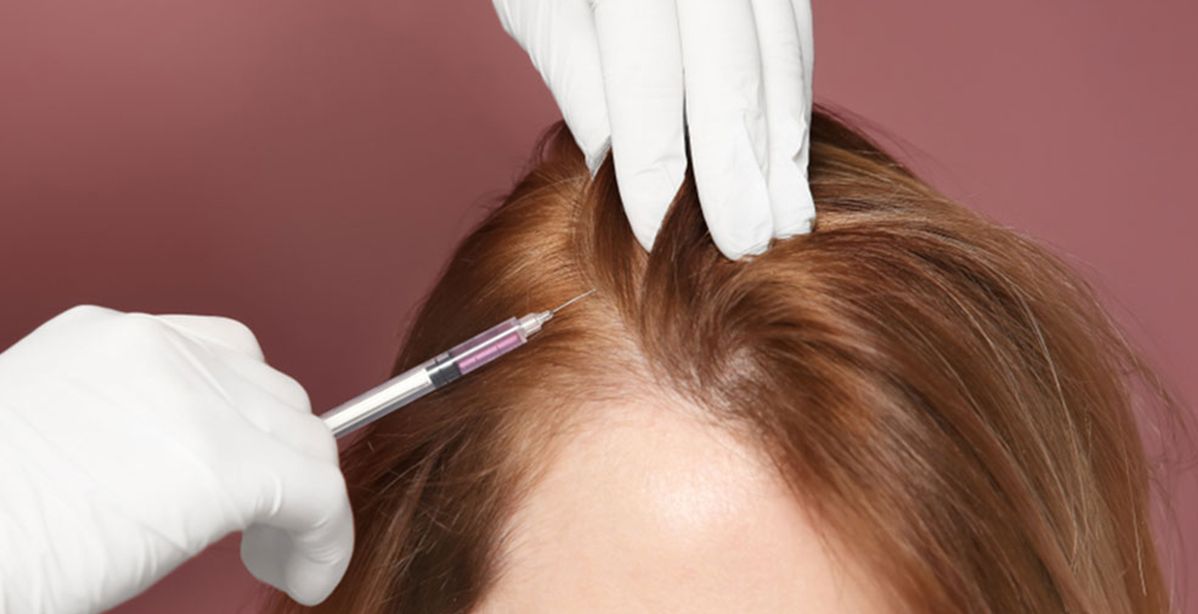 اضرار وفوائد بلازما الشعر