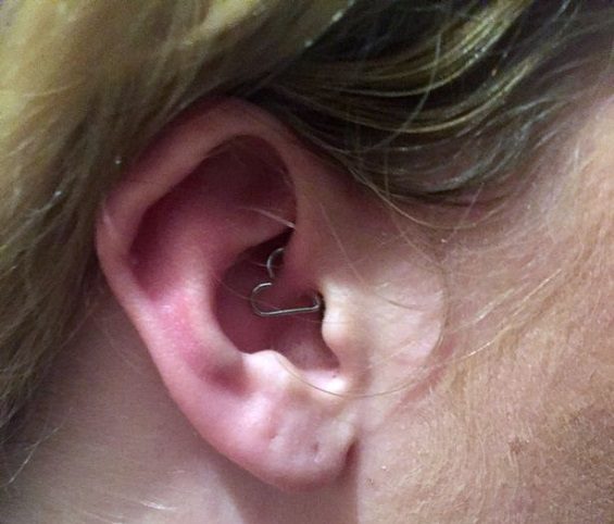صورة سامنتا فيشر تثقب أذنها لعلاج الصداع النصفي