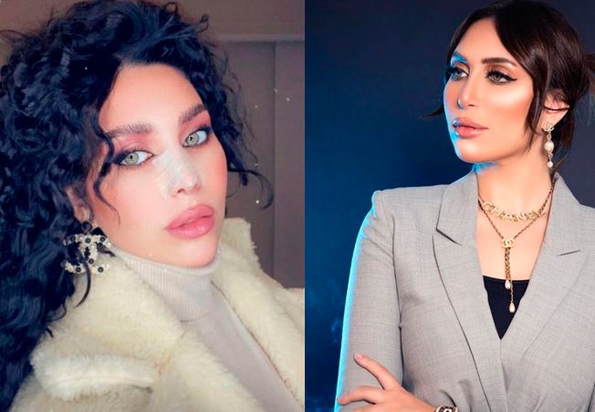 هل تعرضت للإنتقادات؟