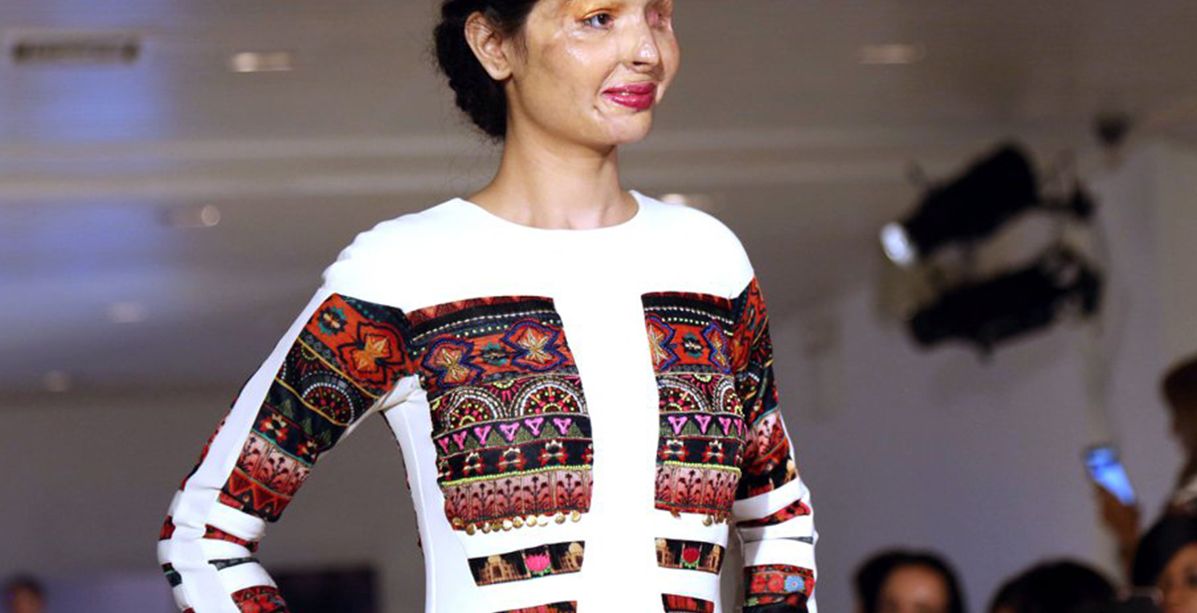 صورة صادمة لفتاة مشوّهة الوجه في منصة أسبوع نيويورك