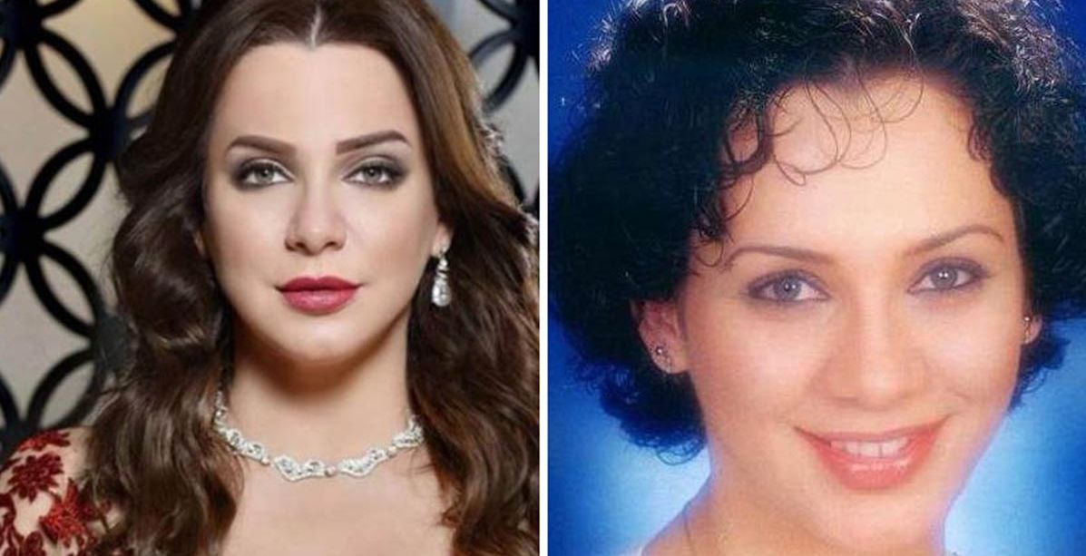 بالصور، نجمات الدراما السورية قبل عمليات التجميل وبعدها