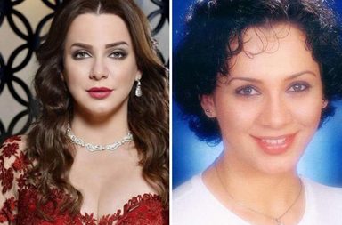 بالصور، نجمات الدراما السورية قبل عمليات التجميل وبعدها