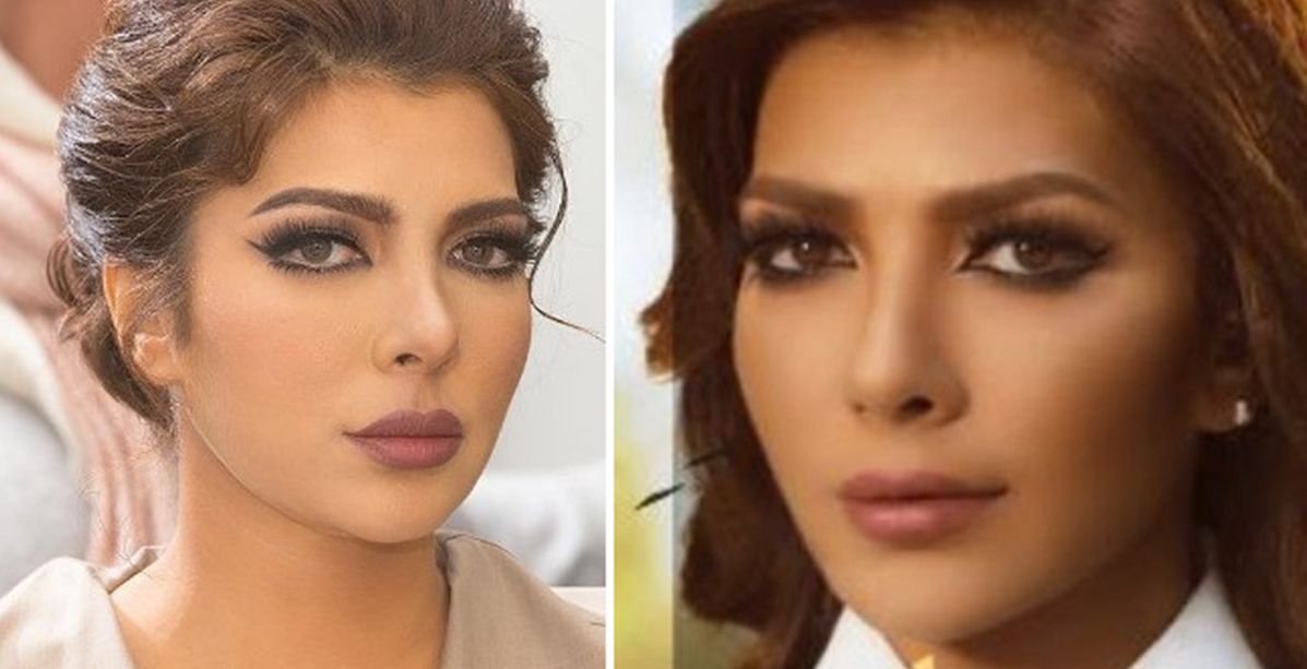 أحدث صورة لأصالة...هل أجرت عملية تجميل جديدة؟ 