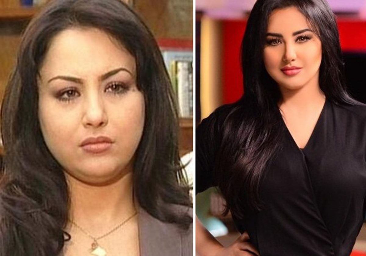 سهير القيسي قبل التجميل وبعده