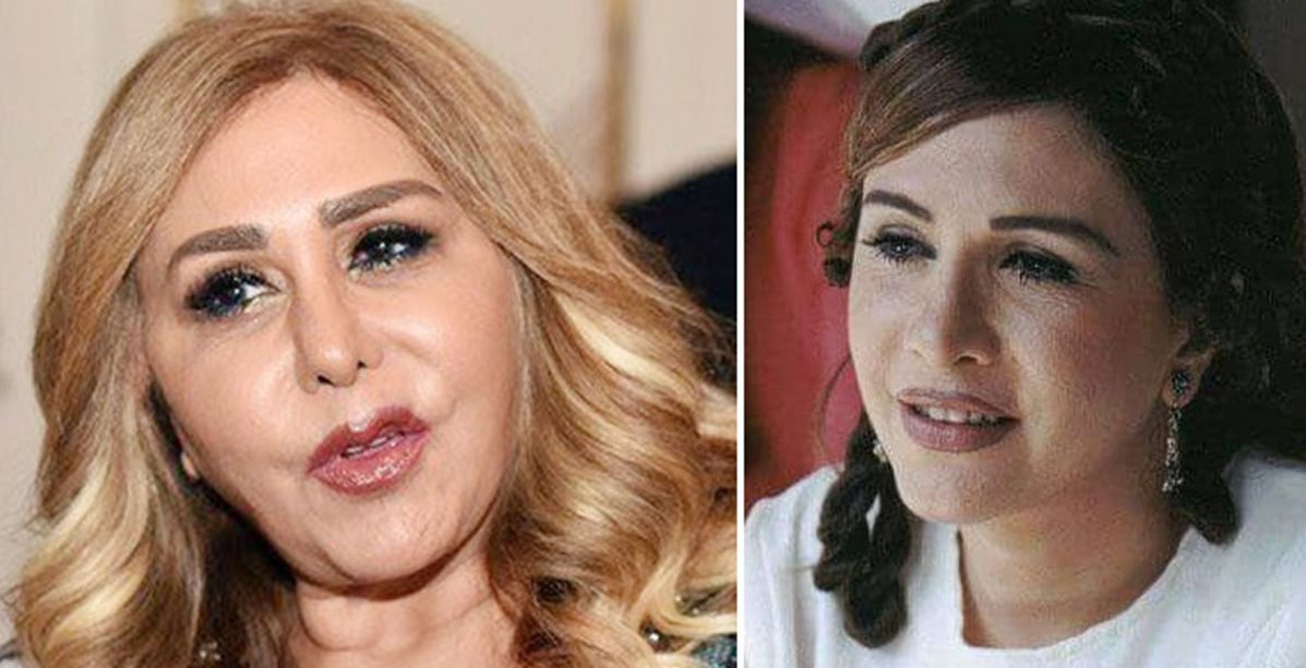 نجمات سوريا وعمليات التجميل: ناجحة عند البعض وتشوهات مخيفة عند البعض الآخر..إليك الصور: