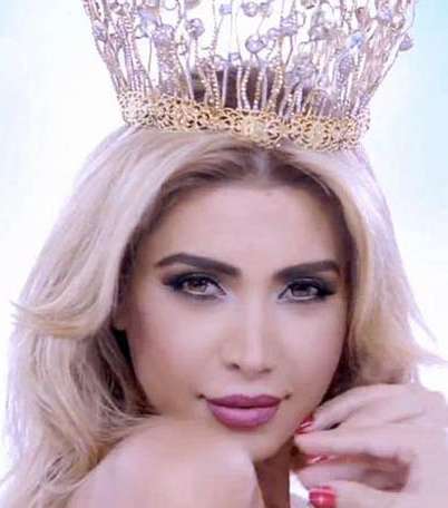 5 فنانات عربيات تألّقن بأكسسوار التاج