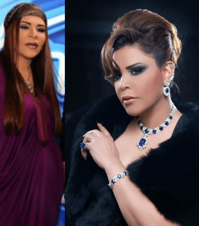 أحلام وخسارتها للوزن الزائد قبل 