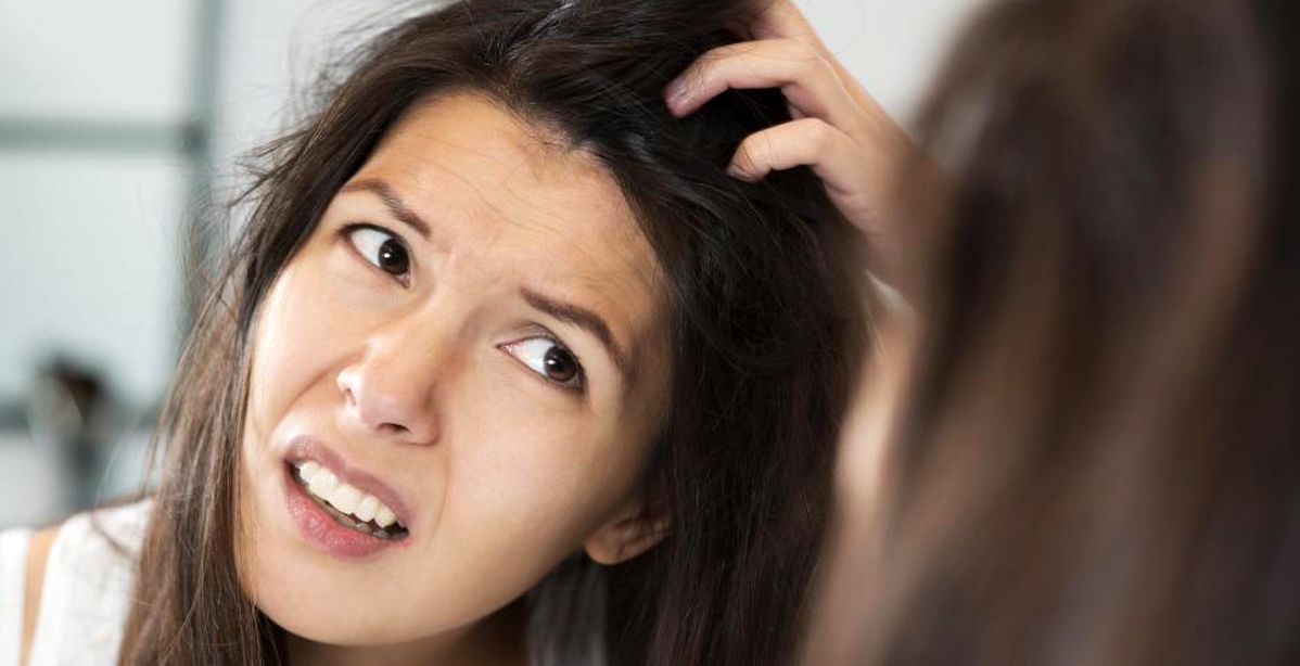 عالجي قشرة الشعر بأسلوب طبيعي في المنزل
