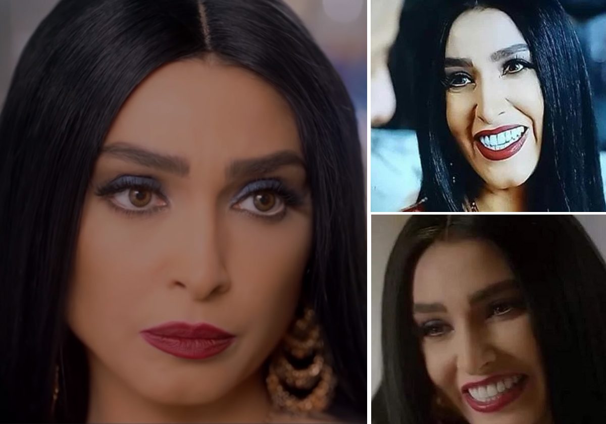 أسنان روجينا في مسلسل البرنس تفضخها وتفضح المخرج!