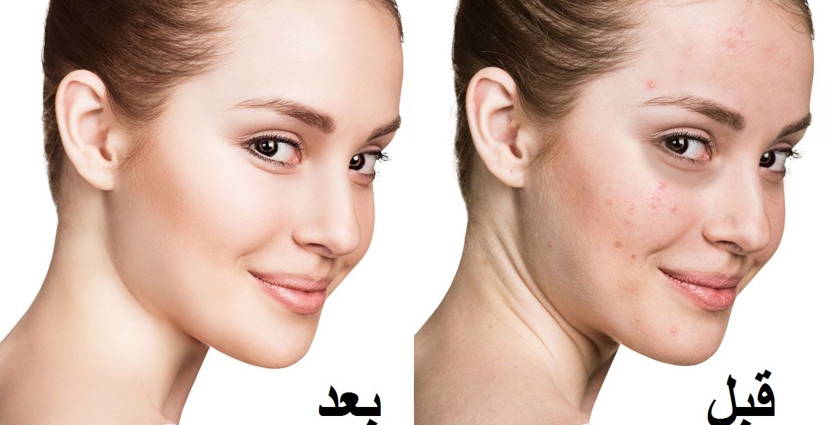 خلطة طبيعية تغنيك عن وضع المكياج في رمضان وتمنحك بشرة نقية خلال 15 دقيقة!