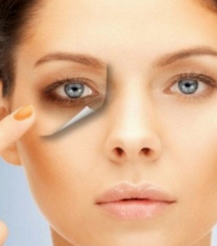 7 طرق لعلاج الهالات السوداء حول العين