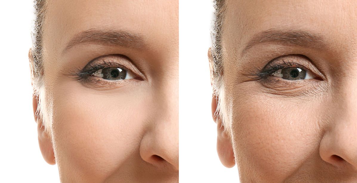 خلطة يابانية تخفي التجاعيد بعد 3 استعمالات وتعطيك تأثير عملية شد البشرة!