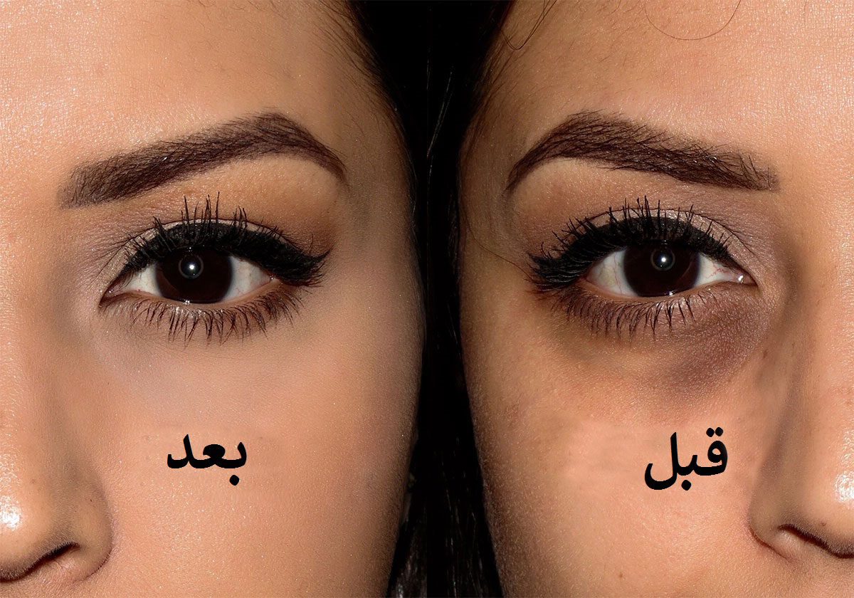 Best concealer for Dark circles on Olive Skin Tones