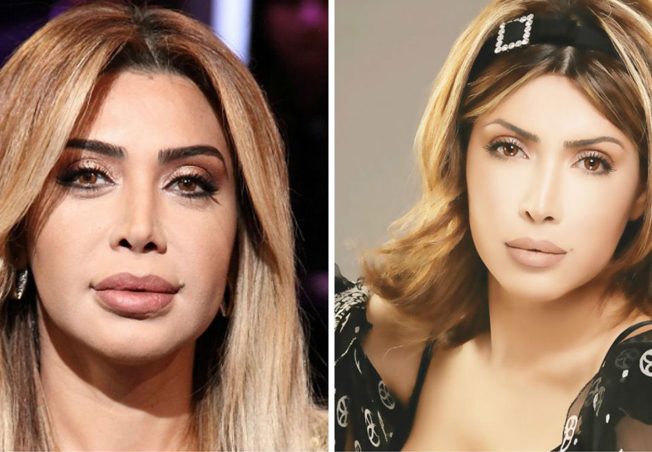 نوال الزغبي قبل تكبير الشفاه