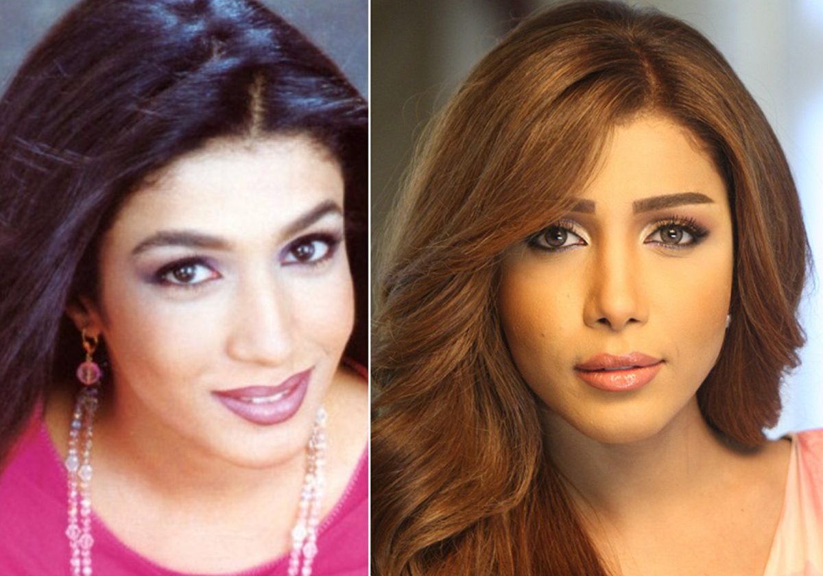 أروى قبل التجميل وبعده